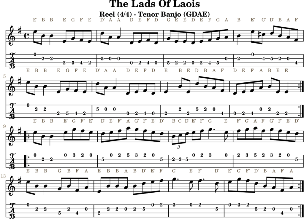 The Lads Of Laois in E Minor — Reel | Tenor Banjo TAB & D Whistle Fingering